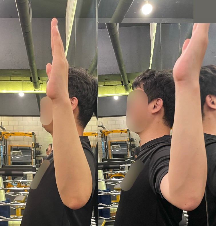 thumb